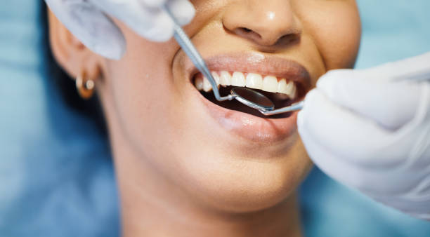 Best Emergency Root Canal Treatment in Waterloo, IA